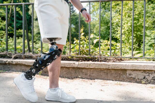 From Fitting To First Steps: A Practical Guide To Lower-Limb Prosthetics